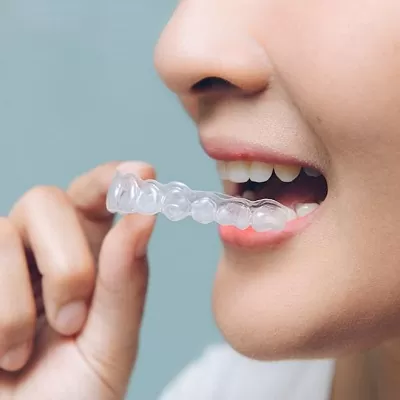 Aligners საქართველო