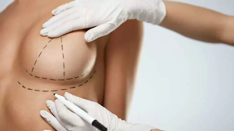 Breast Lift Surgery საქართველო