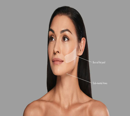 buccal fat removal საქართველო