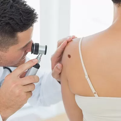 Dermoscopy Mole Evaluation საქართველო