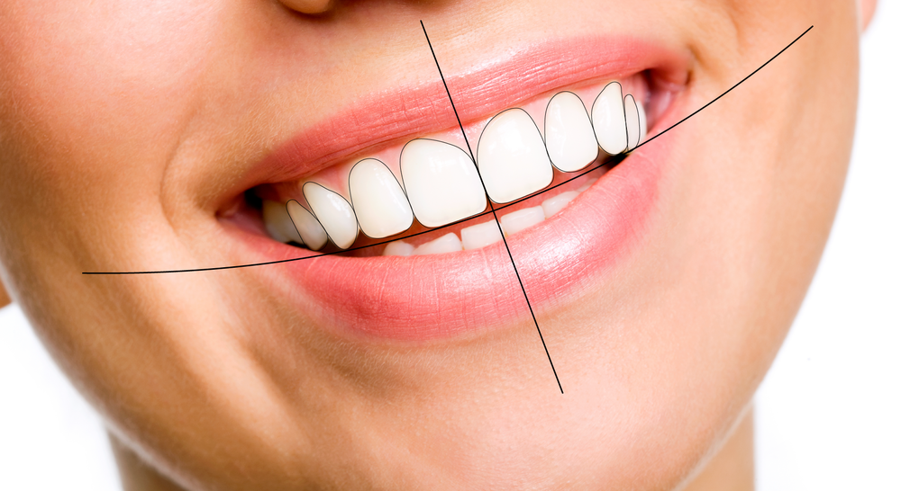 Digital Smile Design საქართველო