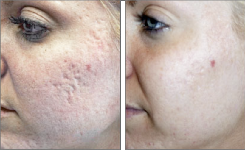 eMatrix Treatment საქართველო