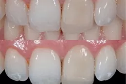 Esthetic Bridge საქართველო