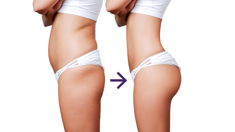 Fat Transfer Surgery საქართველო