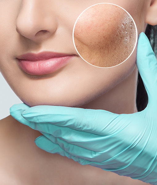 Fotona Twin Light Fractional Rejuvenation საქართველო