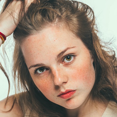 Freckles & Blemishes საქართველო
