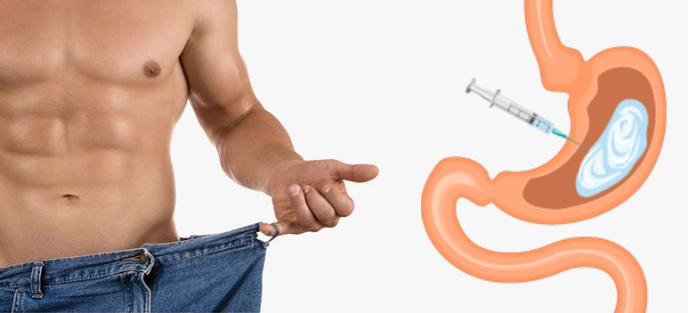 Gastric Botox საქართველო