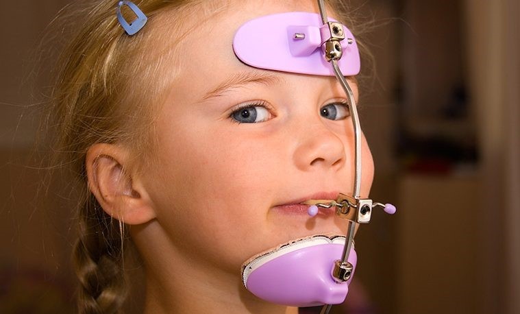 Headgear Treatment საქართველო