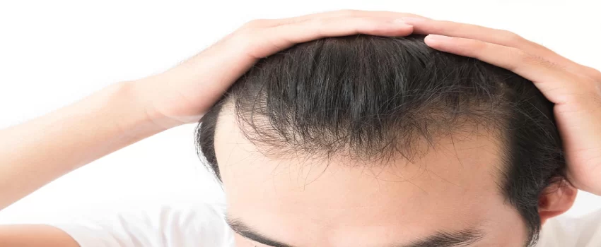 Hybrid Hair Transplant საქართველო