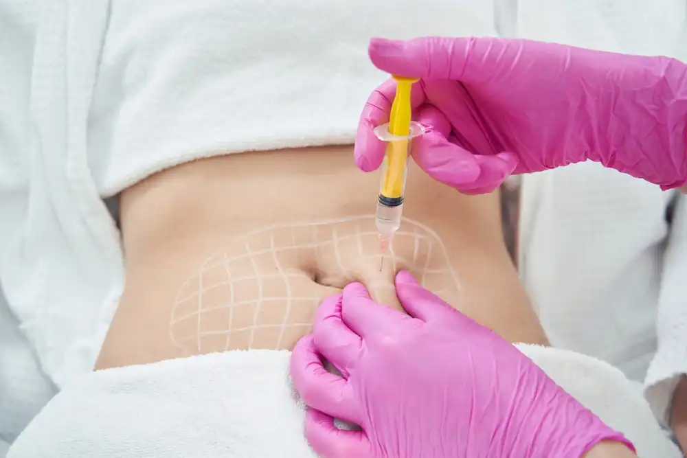Lipolysis Treatment საქართველო