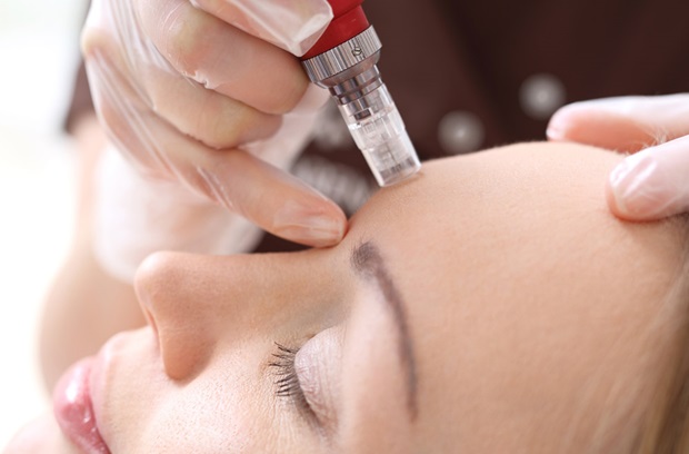 Microneedling Treatment საქართველო