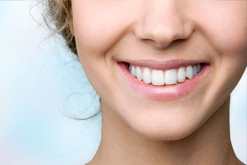 Porcelain Dental Veneers საქართველო