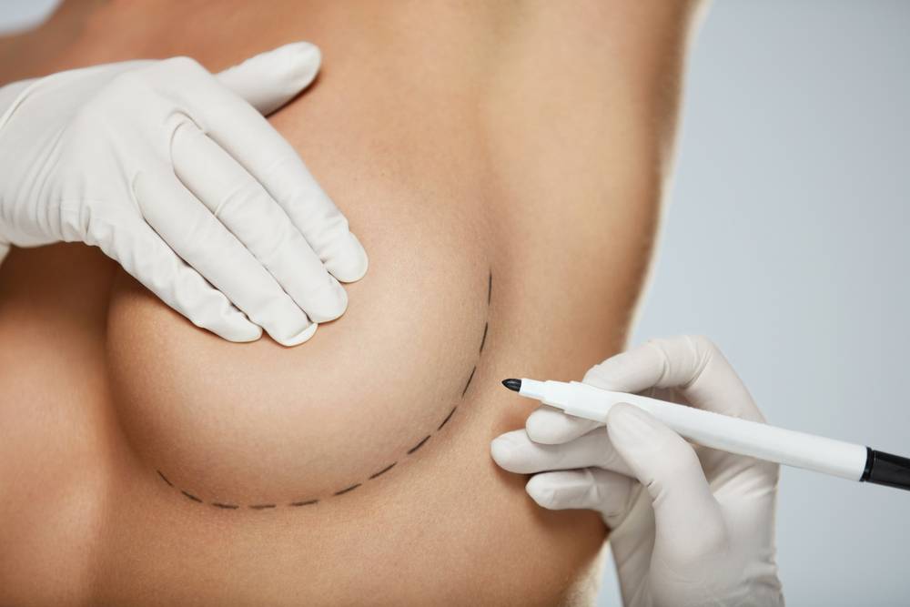 Short Scar Breast Augmentation საქართველო