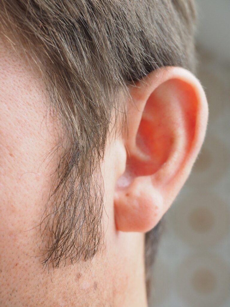 Sideburn Hair Transplant საქართველო