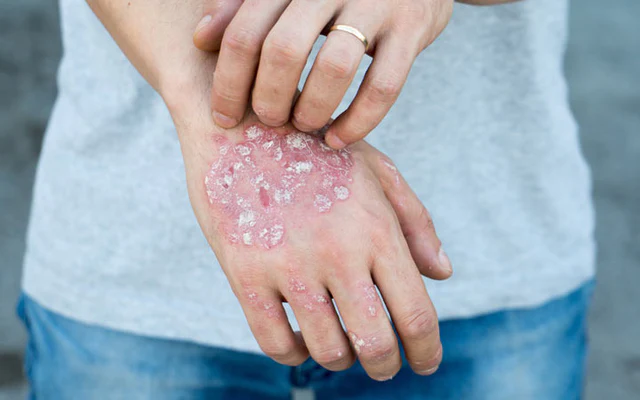 Skin Diseases საქართველო