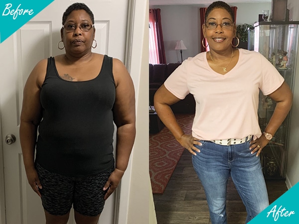 Sleeve Gastrectomy - საქართველო