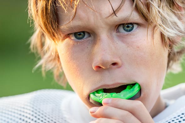 Sports Mouth Guard საქართველო