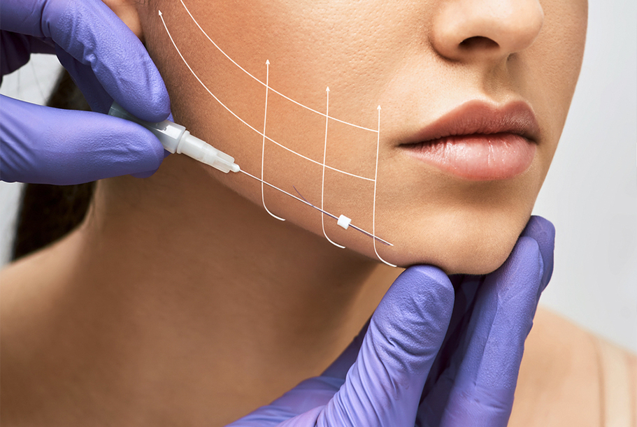 Thread Lift Treatment საქართველო