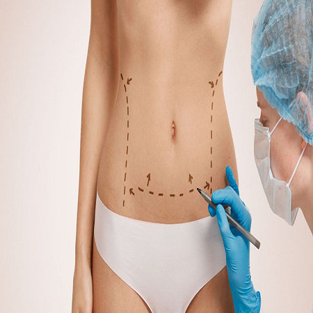 tummy tuck surgery abdominoplasty საქართველო